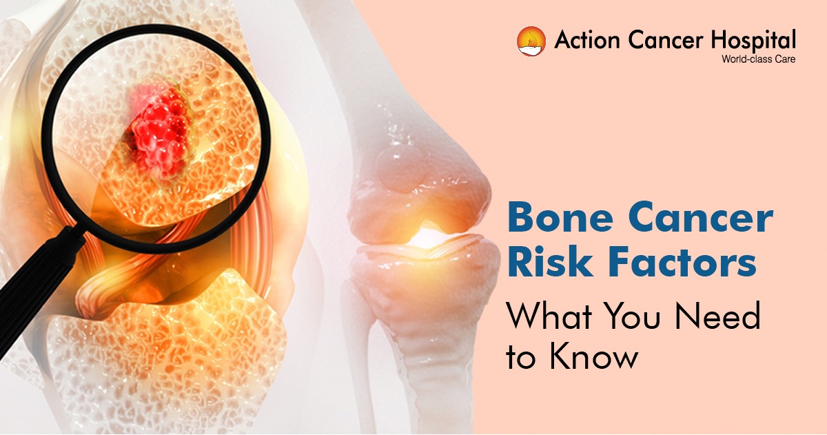 Bone Cancer Risk Factors: What You Need to Know